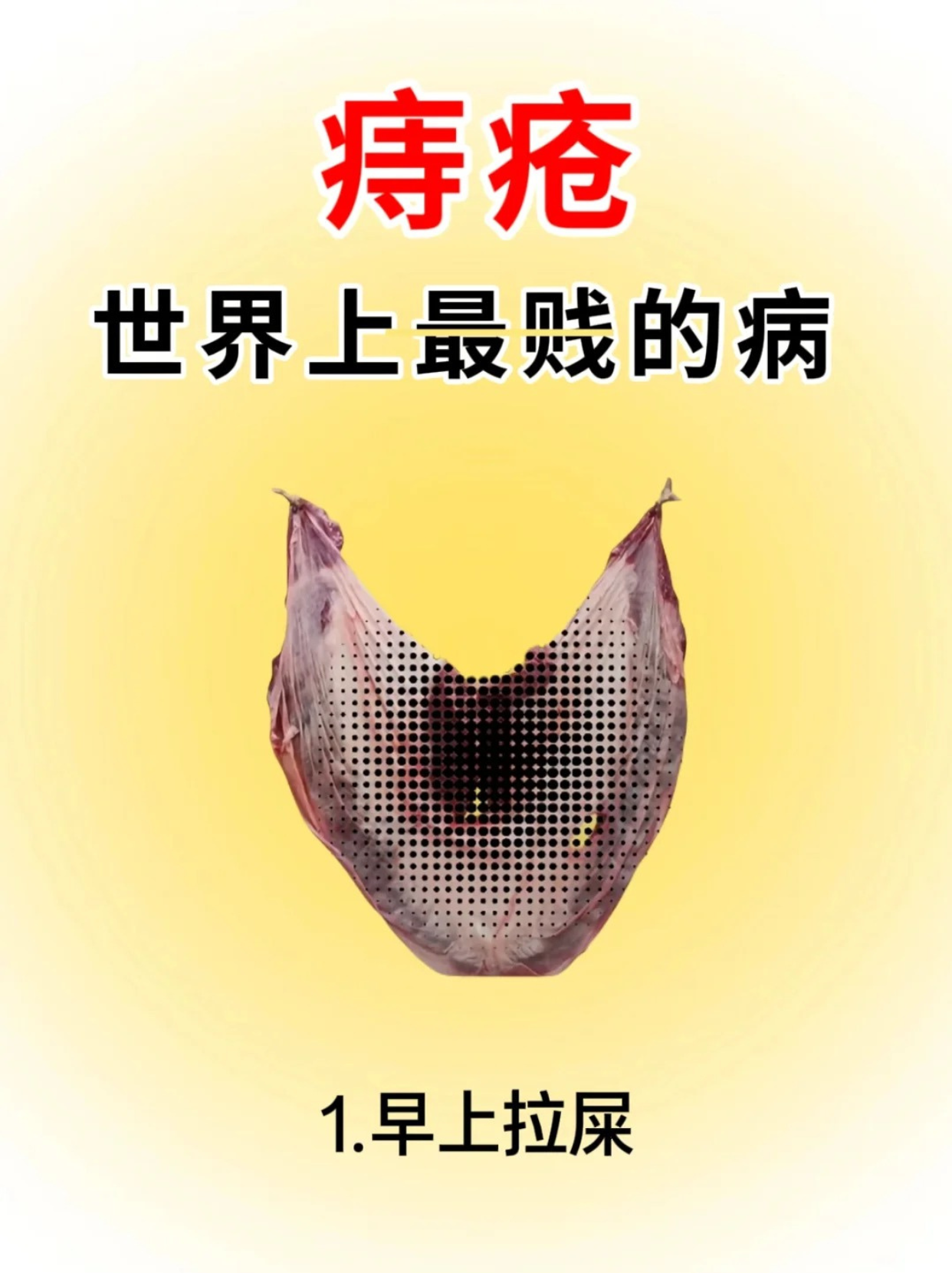 孕妇长痔疮怎么办