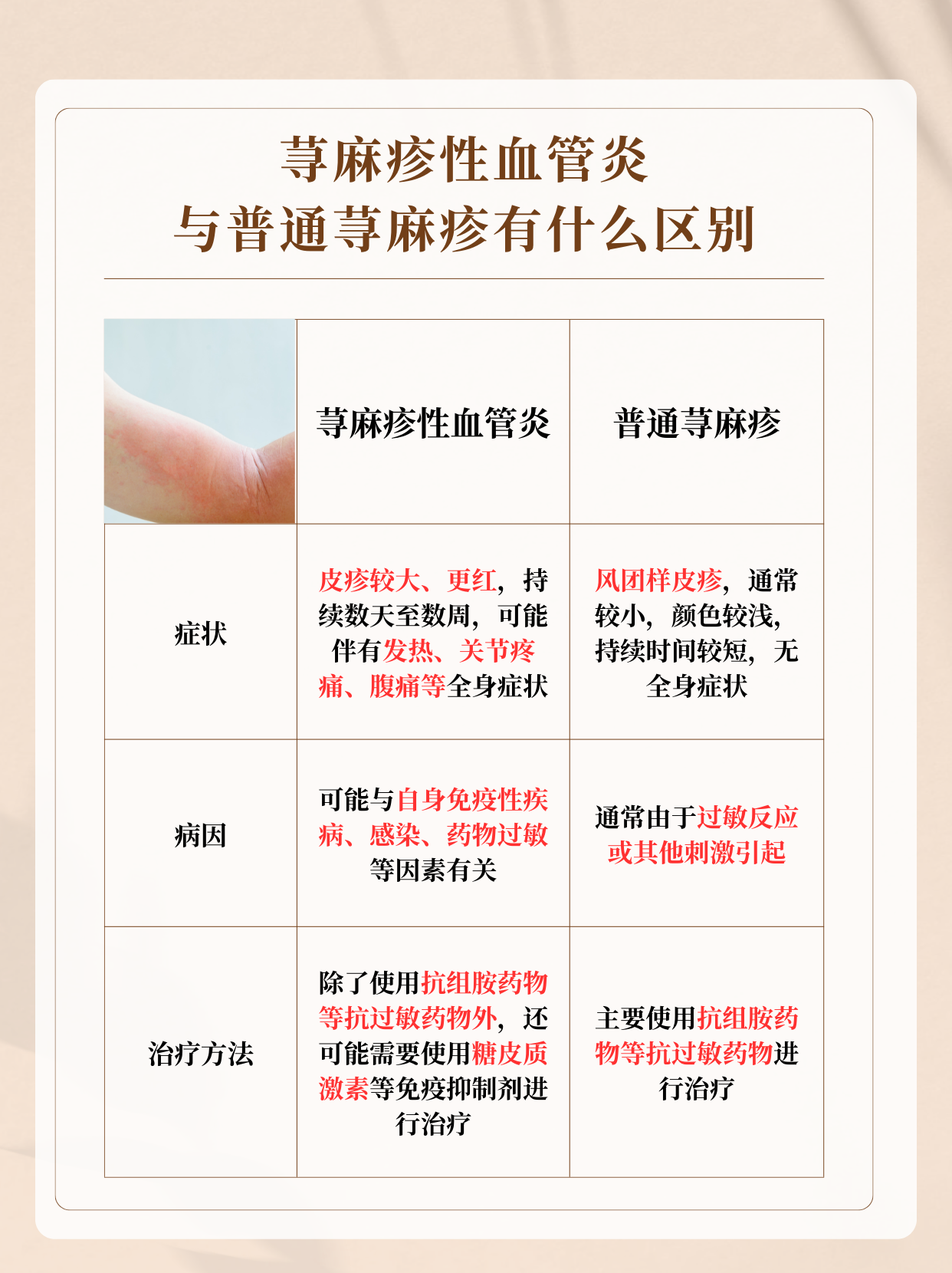 什么是变应性血管炎