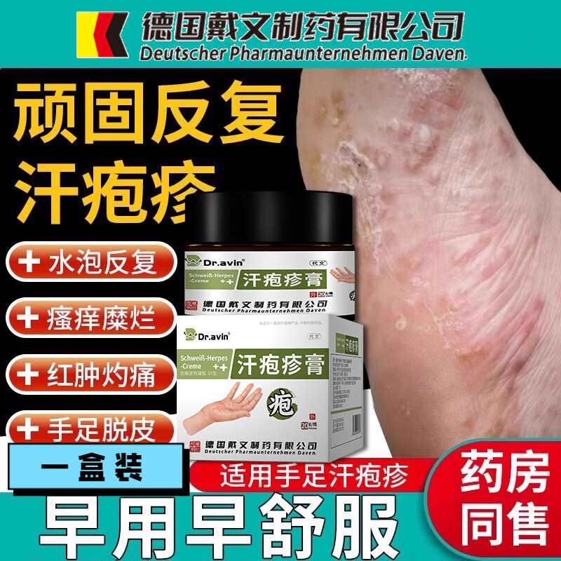 治疗疱疹的药有哪些