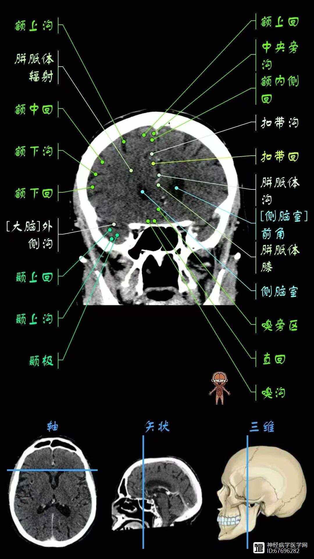 颅脑CT检查方法