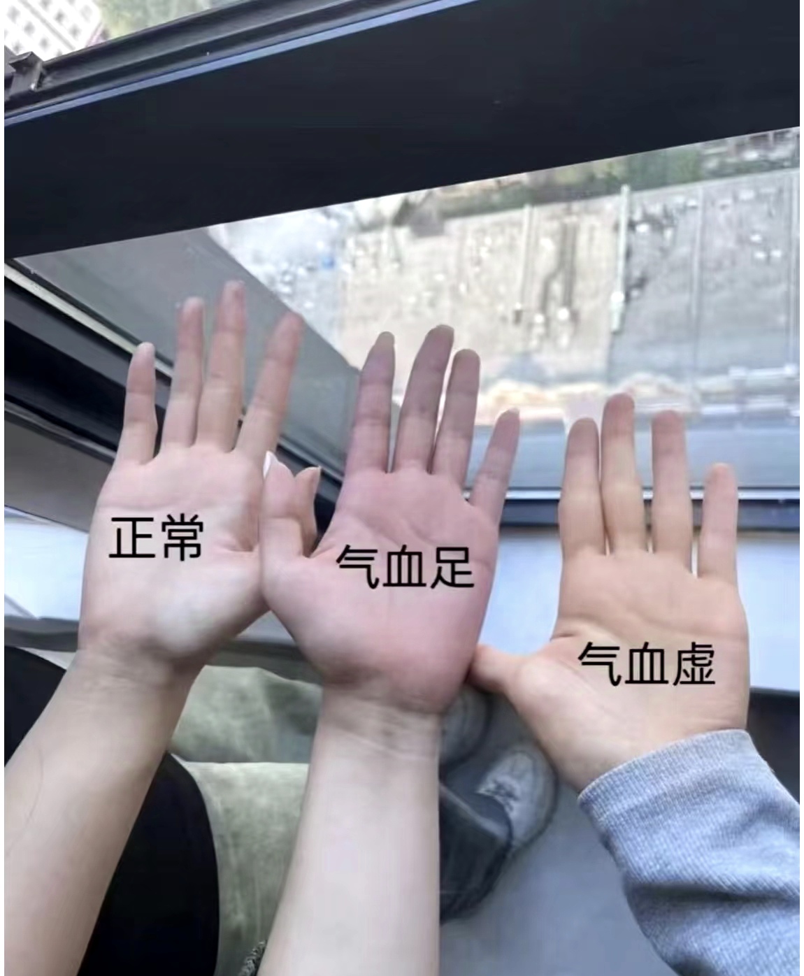 手发胀是什么原因造成的
