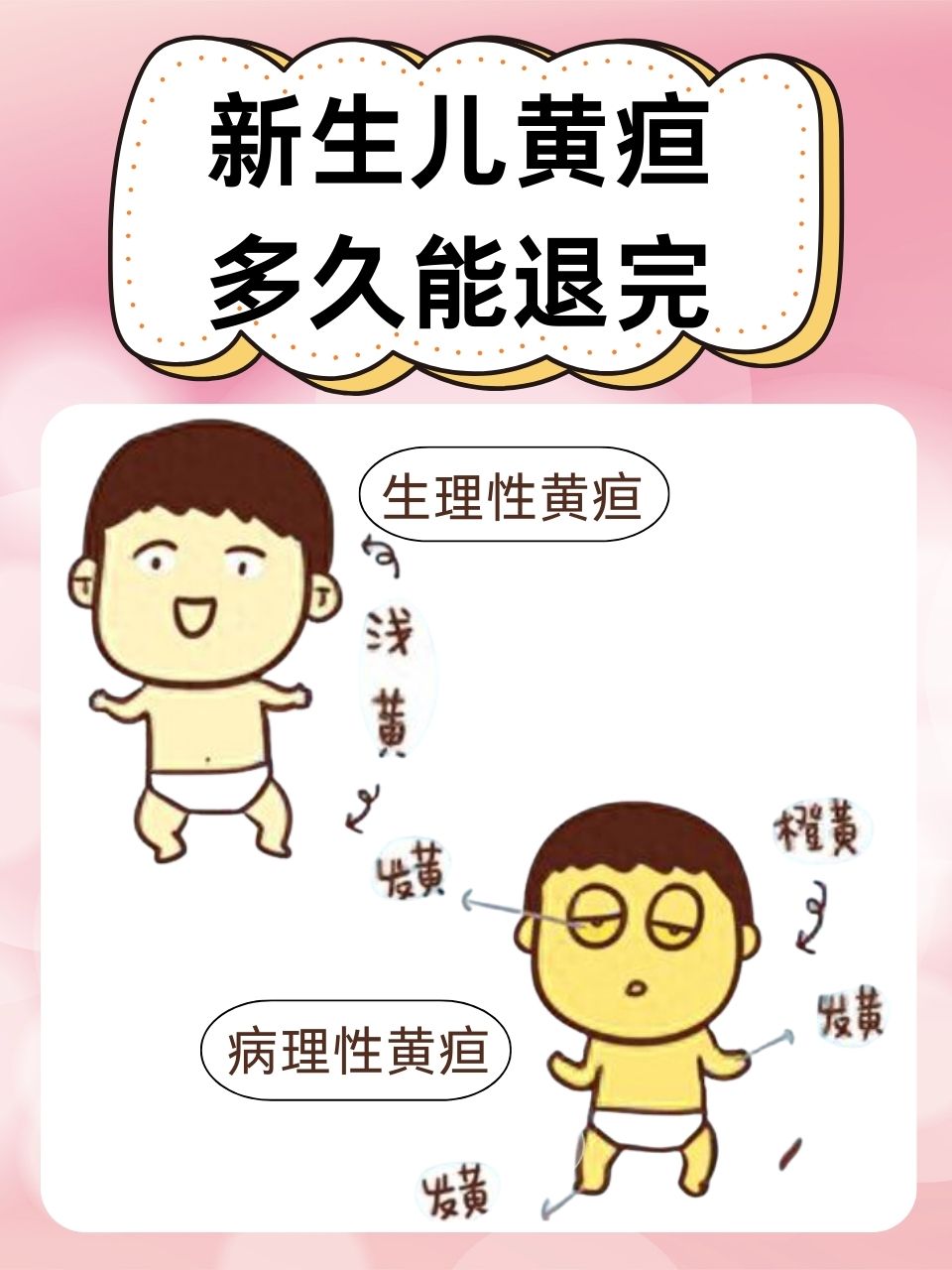 新生儿黄疸偏高的原因是什么