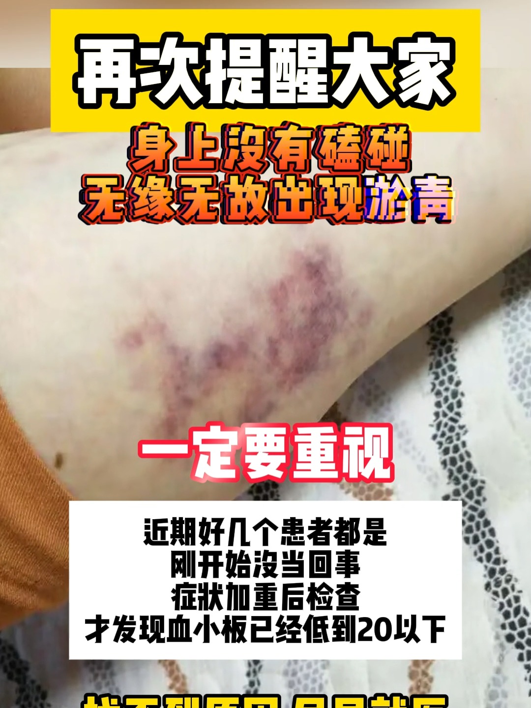 血小板减少会有什么症状