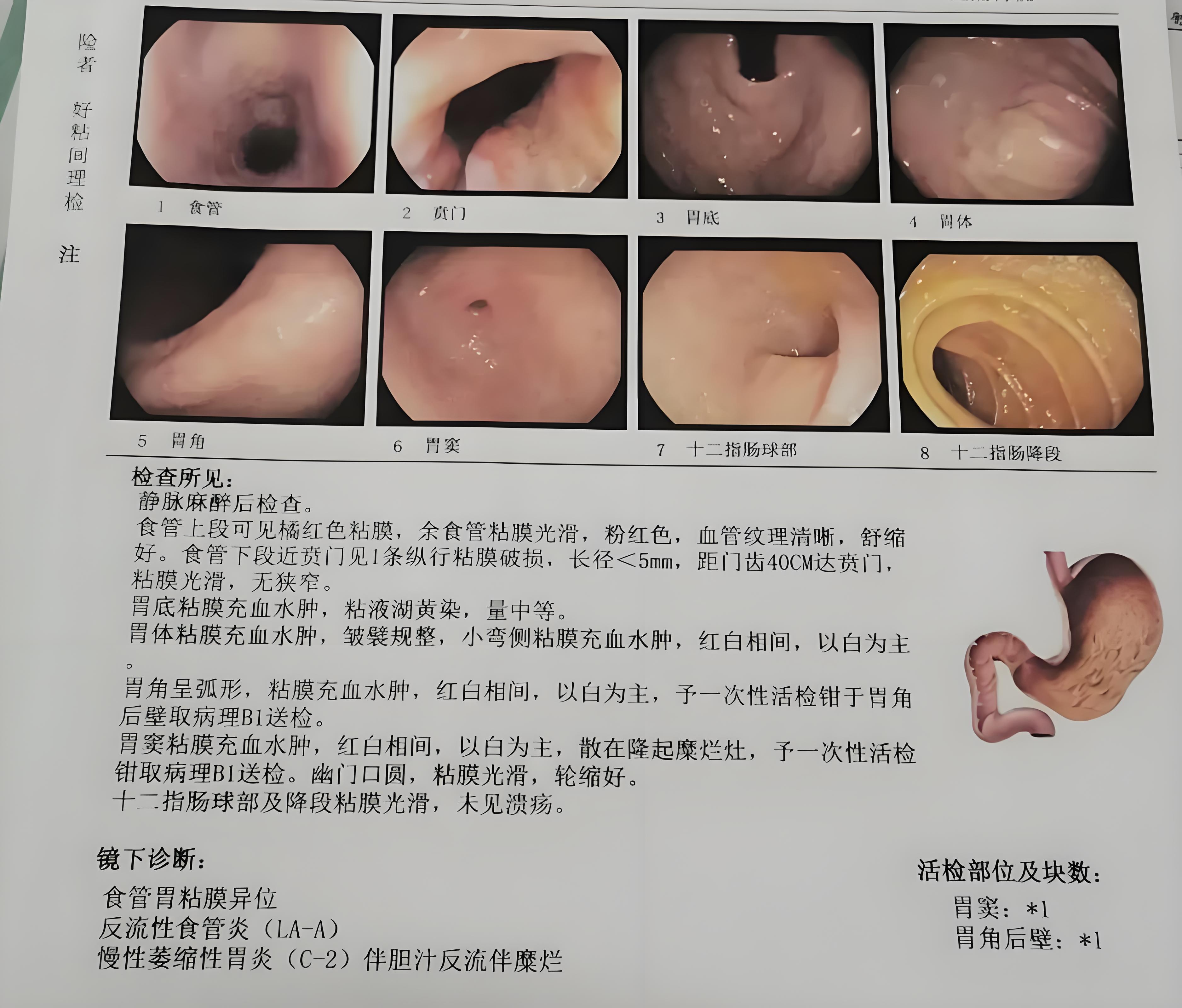胃炎的症状有哪些
