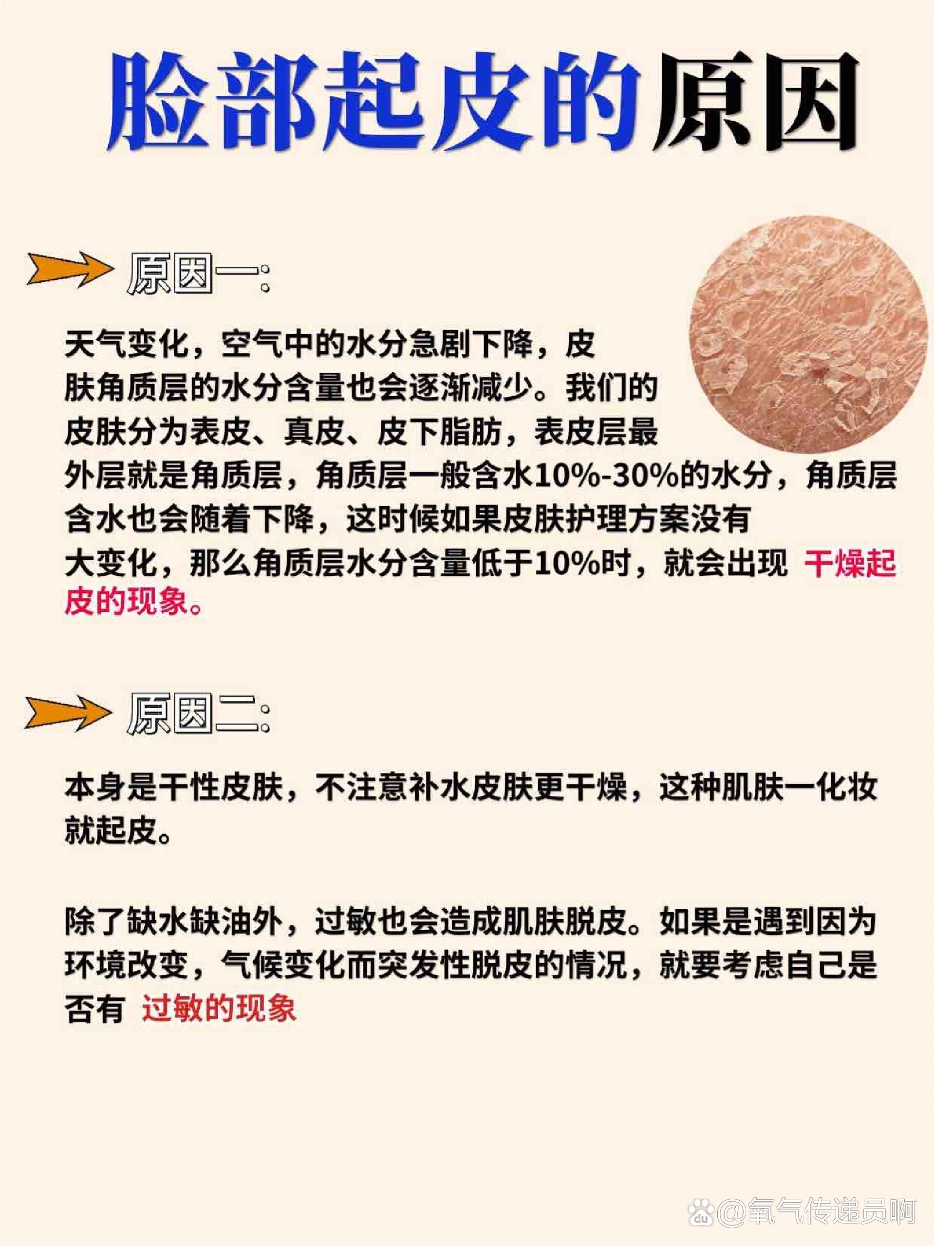 脸上老是起皮怎么回事?