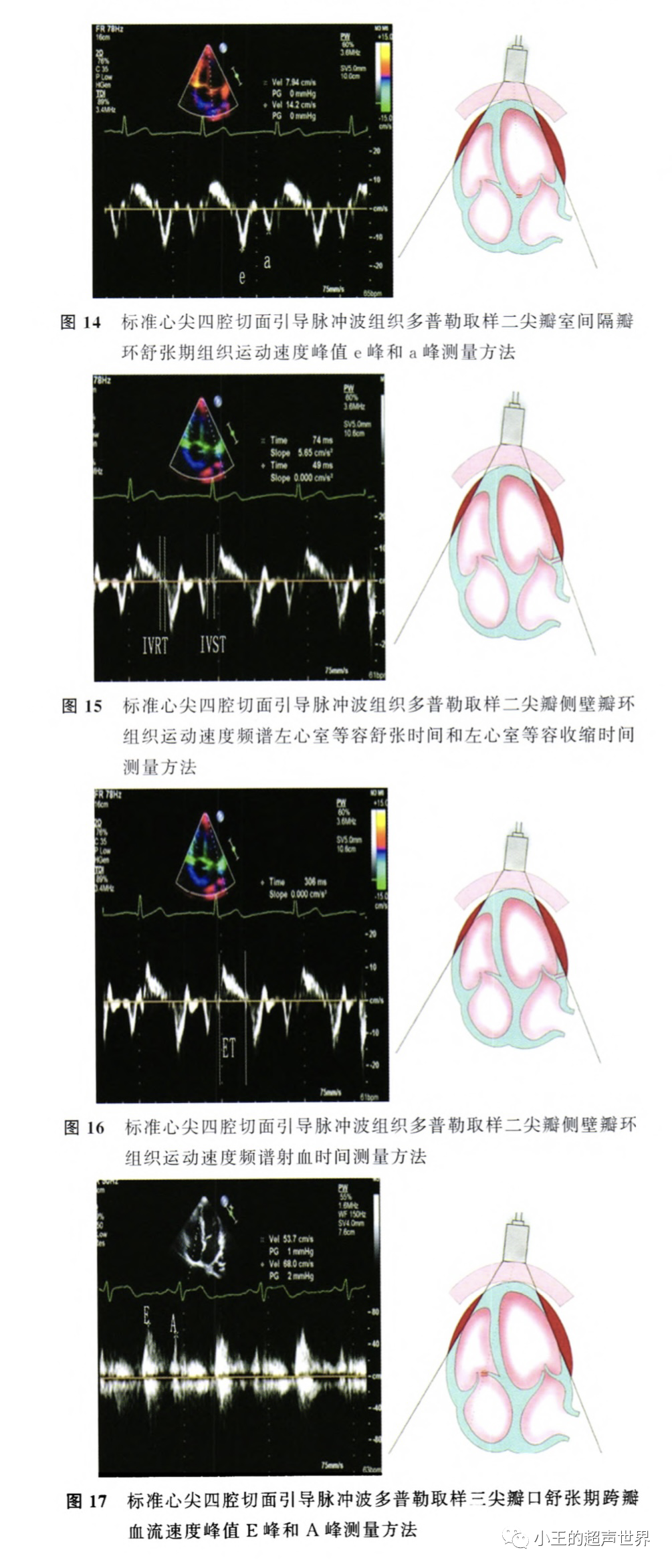 胎儿超声心动图检查什么