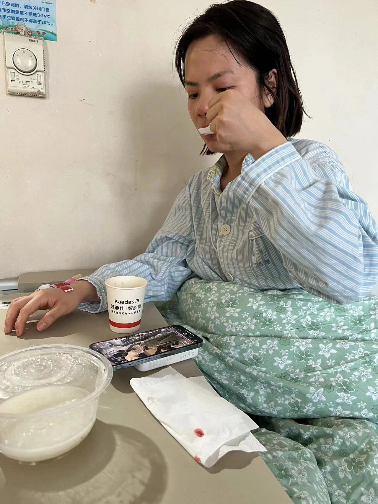 鼻息肉手术