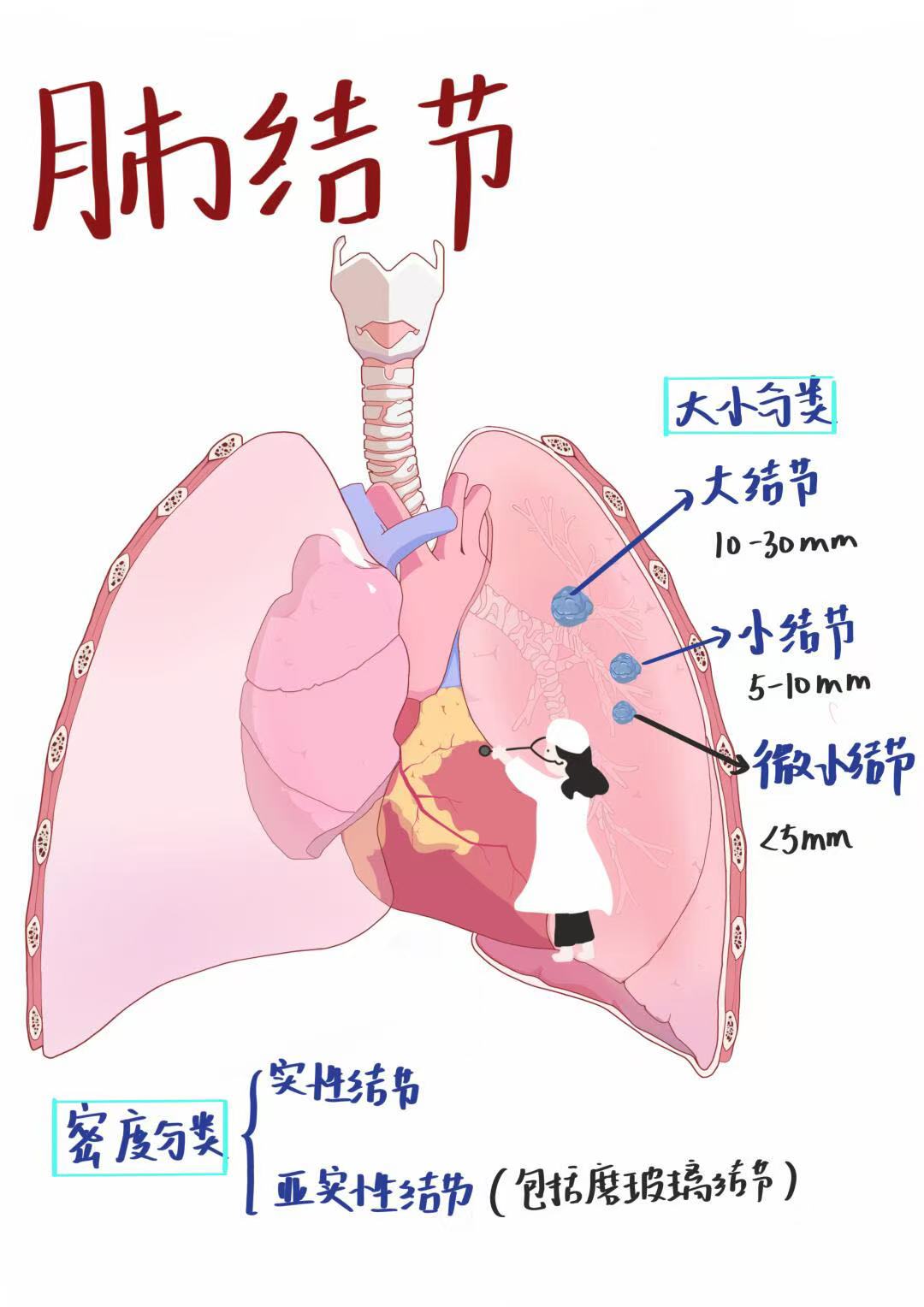肺结节的症状有哪些