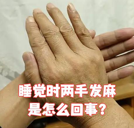 两手发麻是怎么回事?