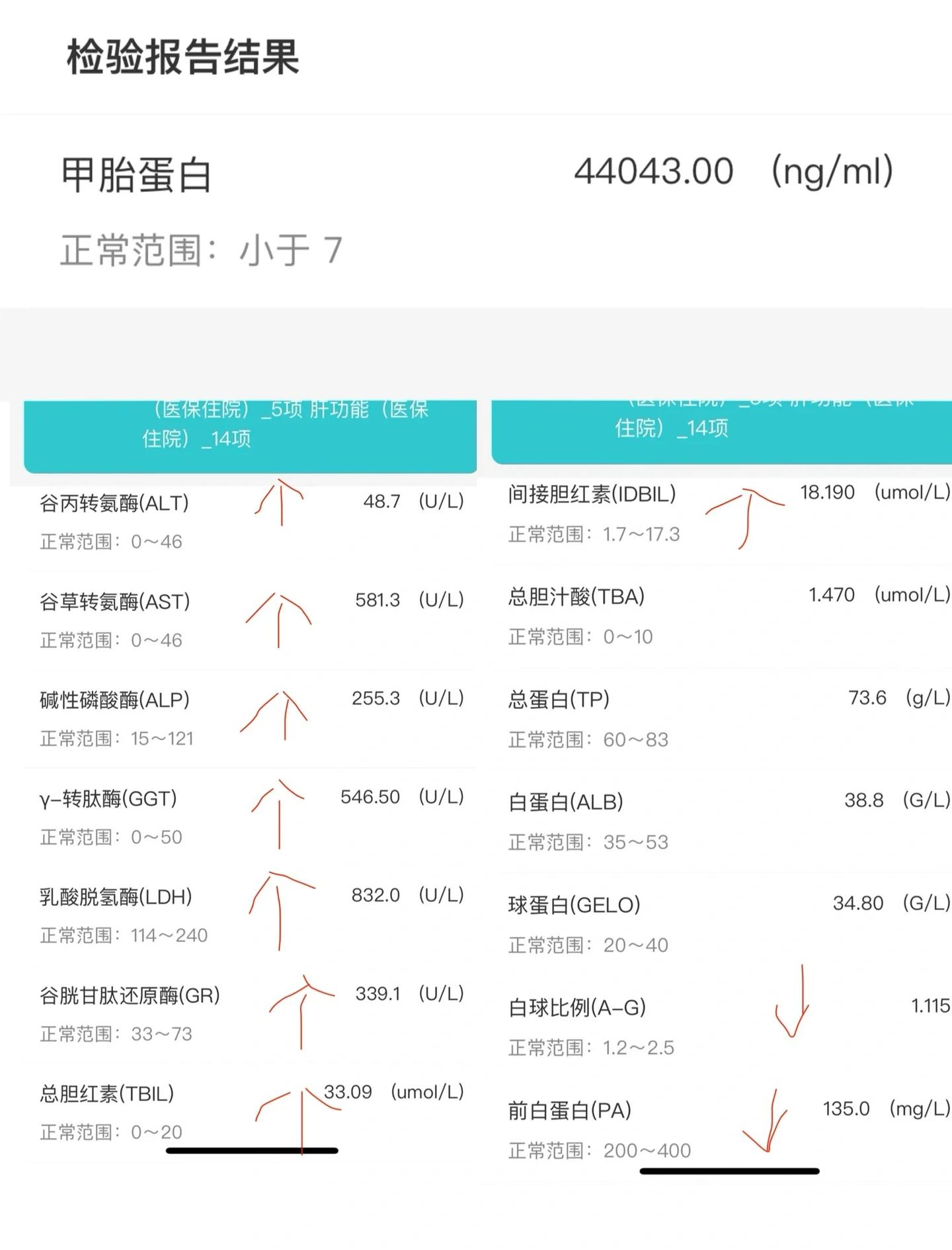 甲胎蛋白偏高