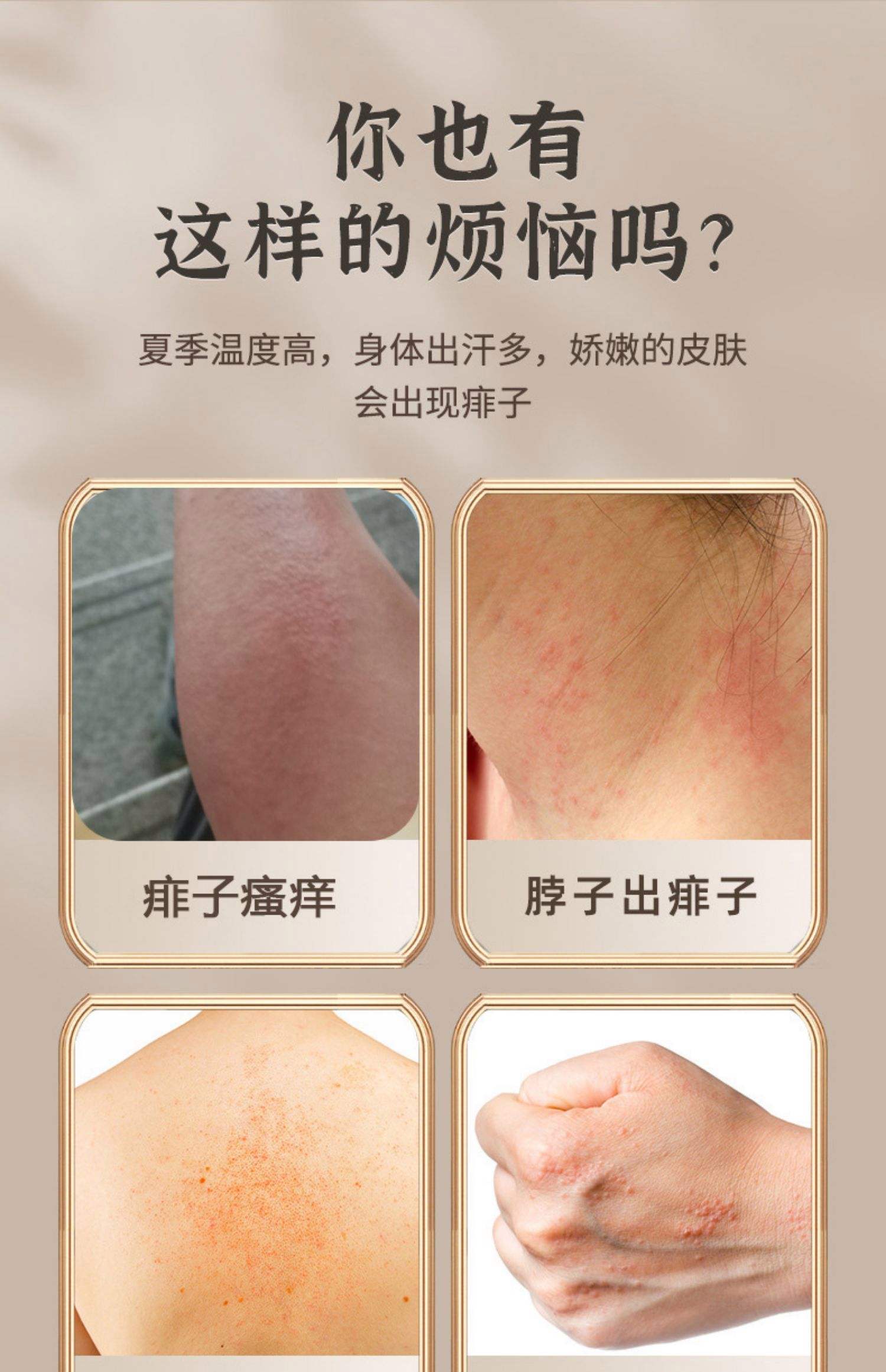 脸上起痱子了该怎么办