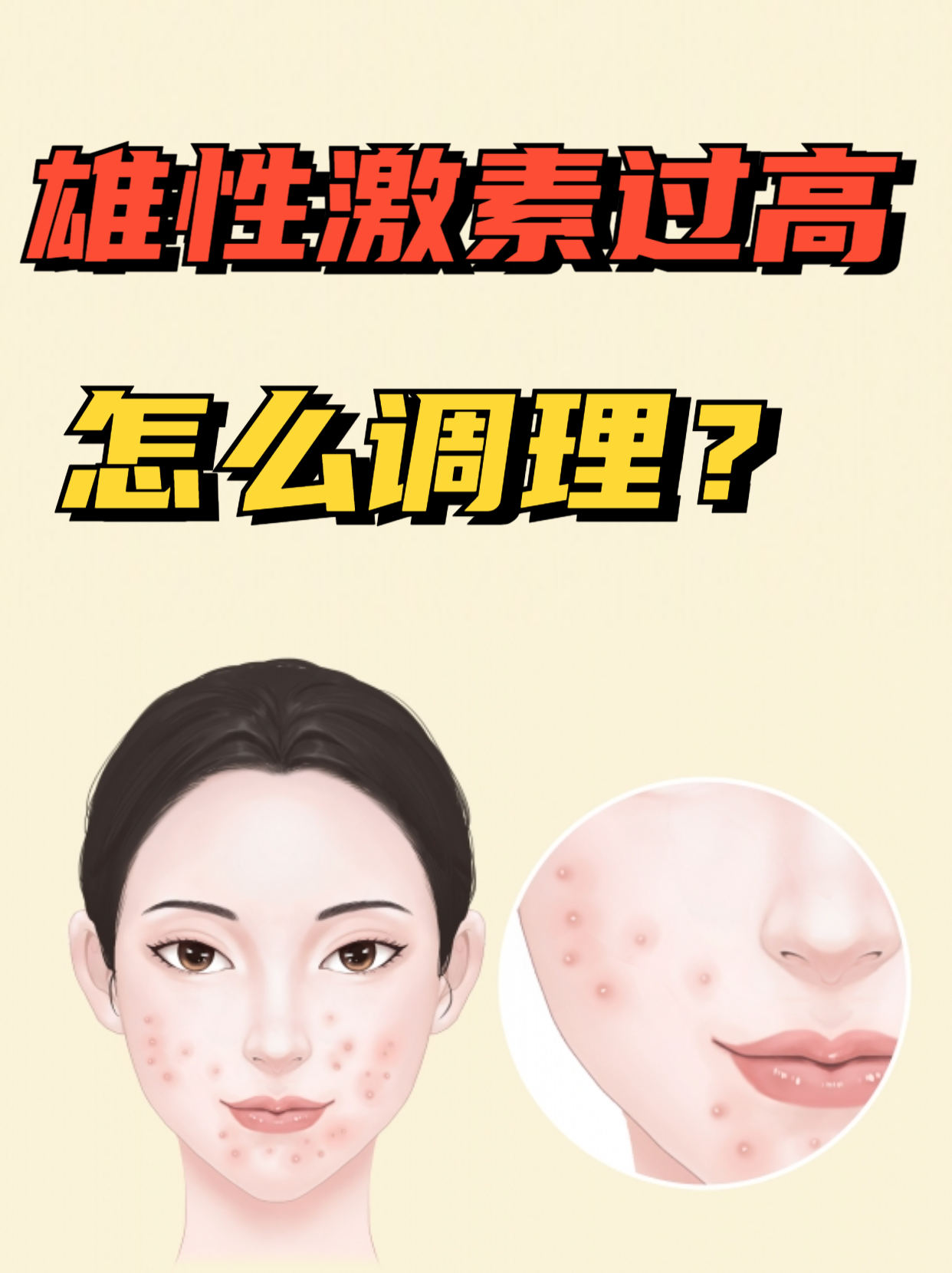 雌性激素过高怎么办.