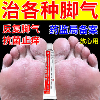 糜烂型脚气用什么药能根治
