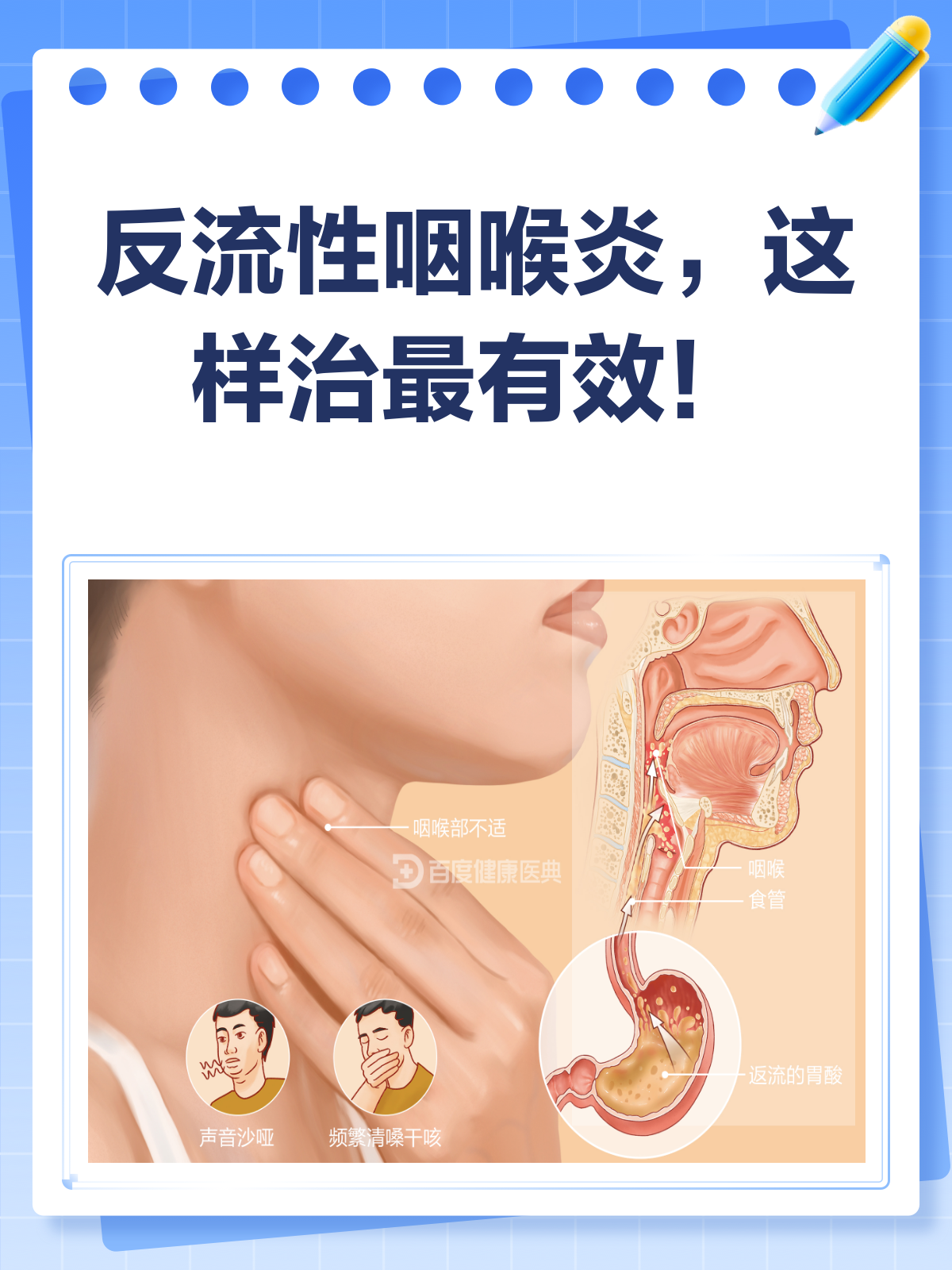 咽炎可以治愈吗?