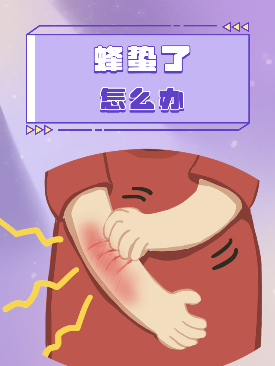 被马蜂蛰了怎么办?