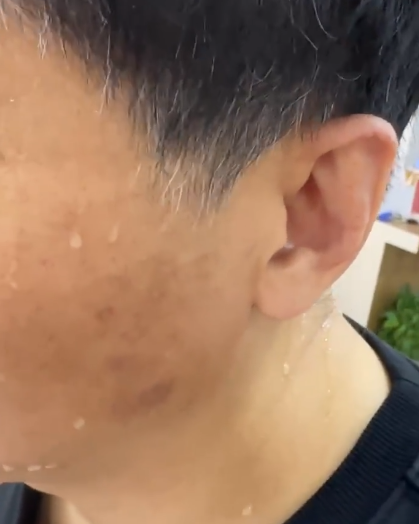 稍微一动就出汗怎么回事
