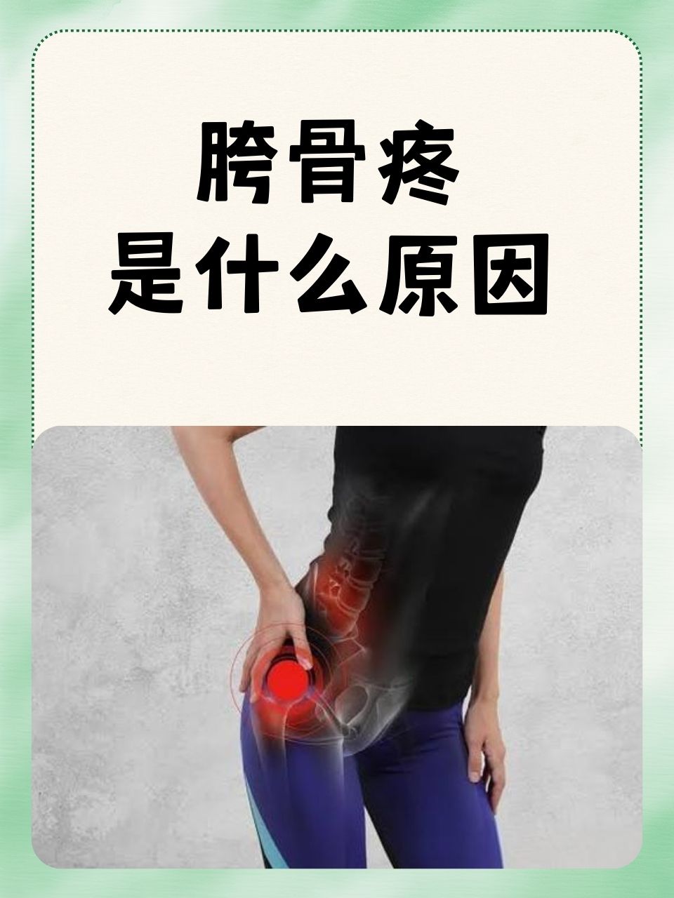 股骨头疼痛是怎么回事