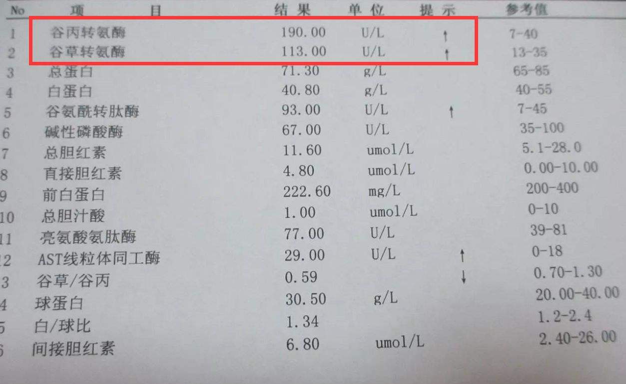 谷丙转氨酶偏高严重吗