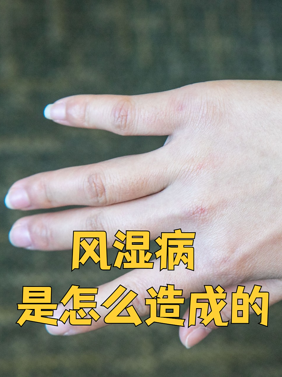 风湿与类风湿区别