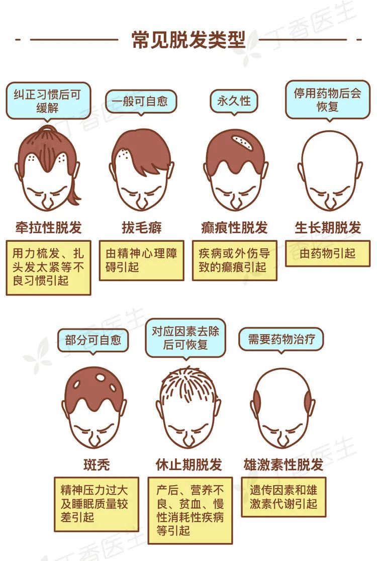 为什么老是掉头发?