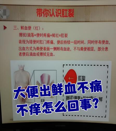 大便出血很多,但是不疼