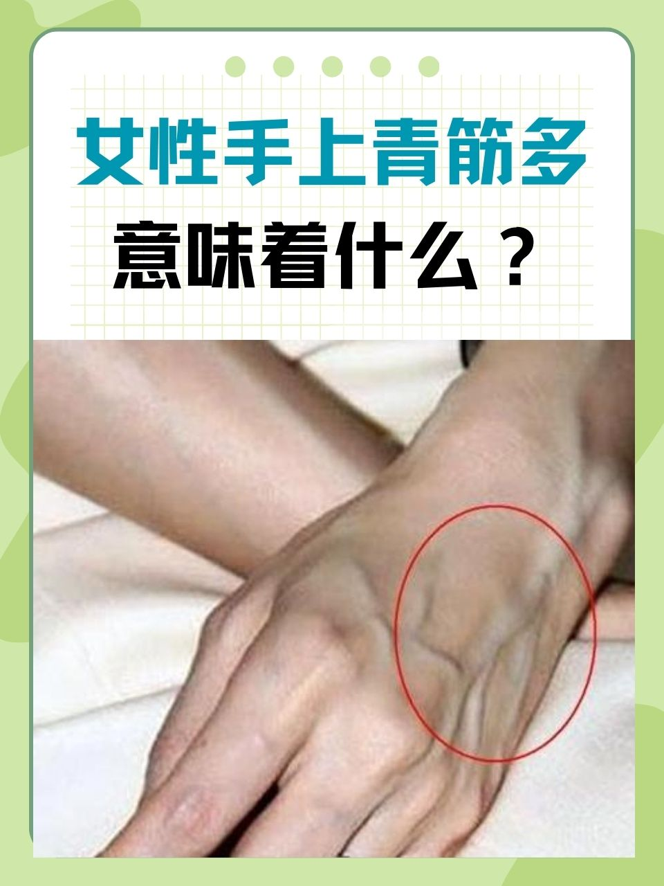 手背青筋很突出怎么回事