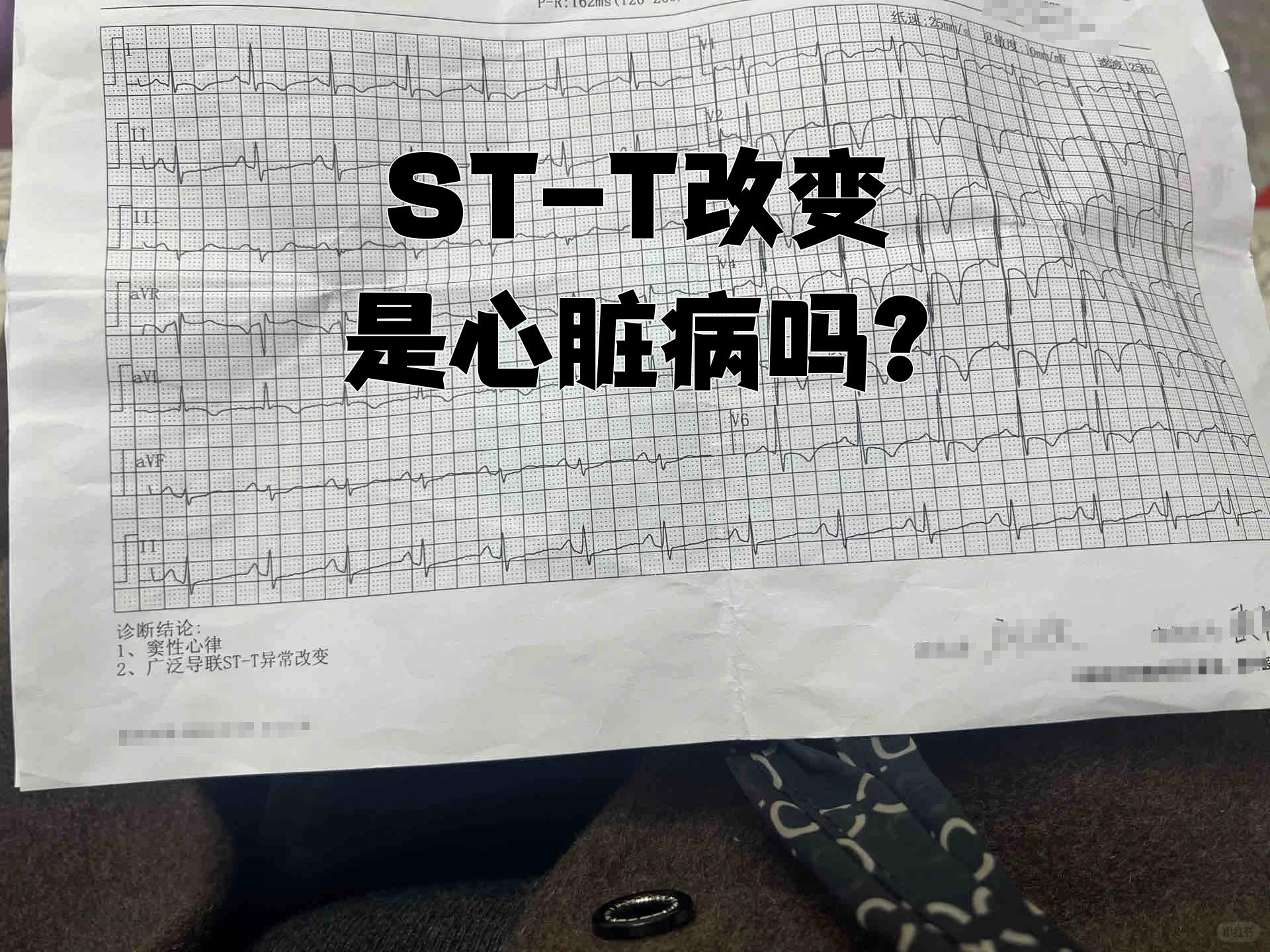 t波改变会是冠心病吗