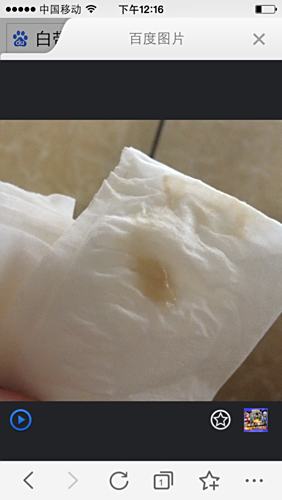 怀孕了还会有白带吗?