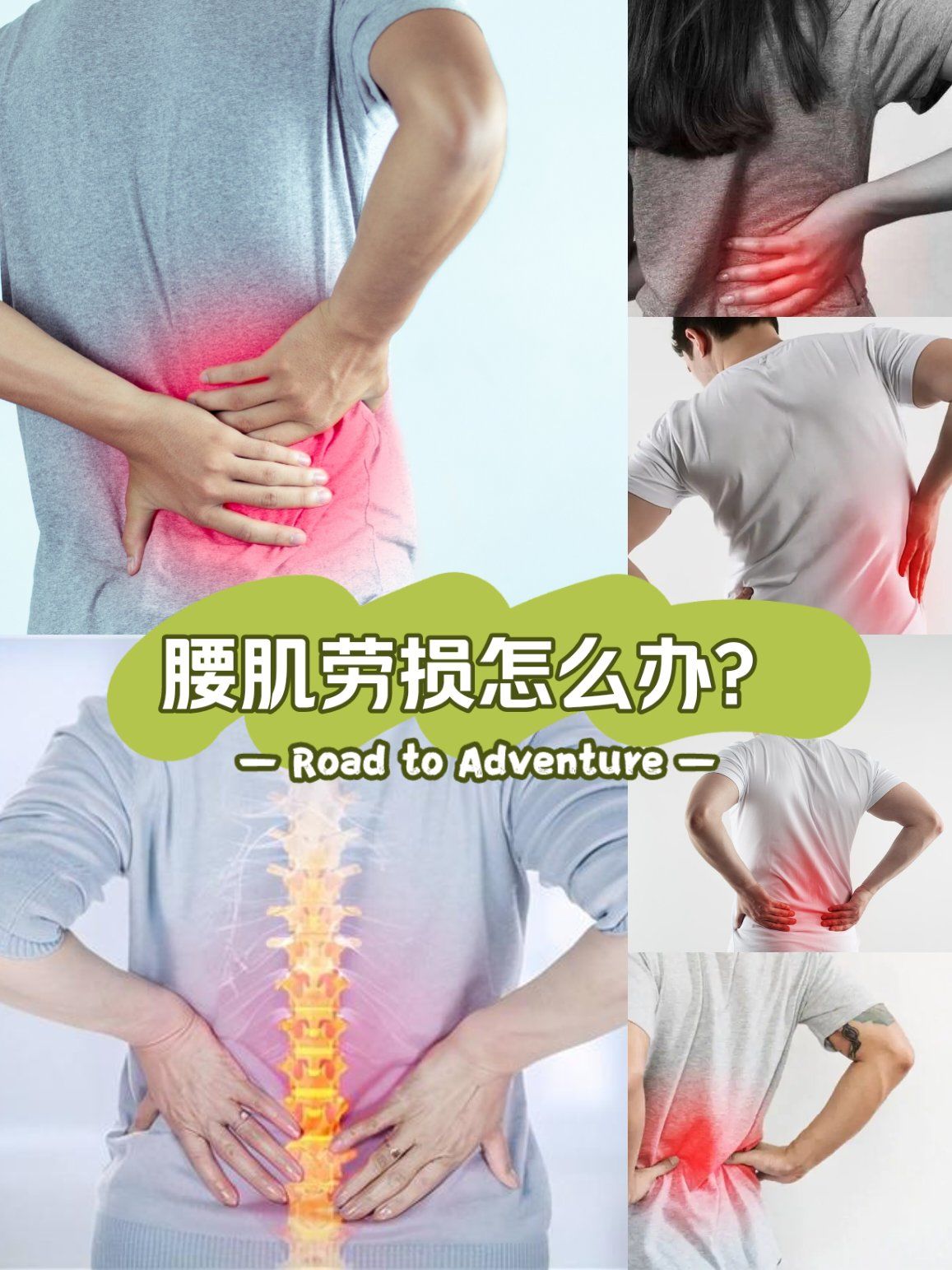 腰肌筋膜炎的症状有哪些