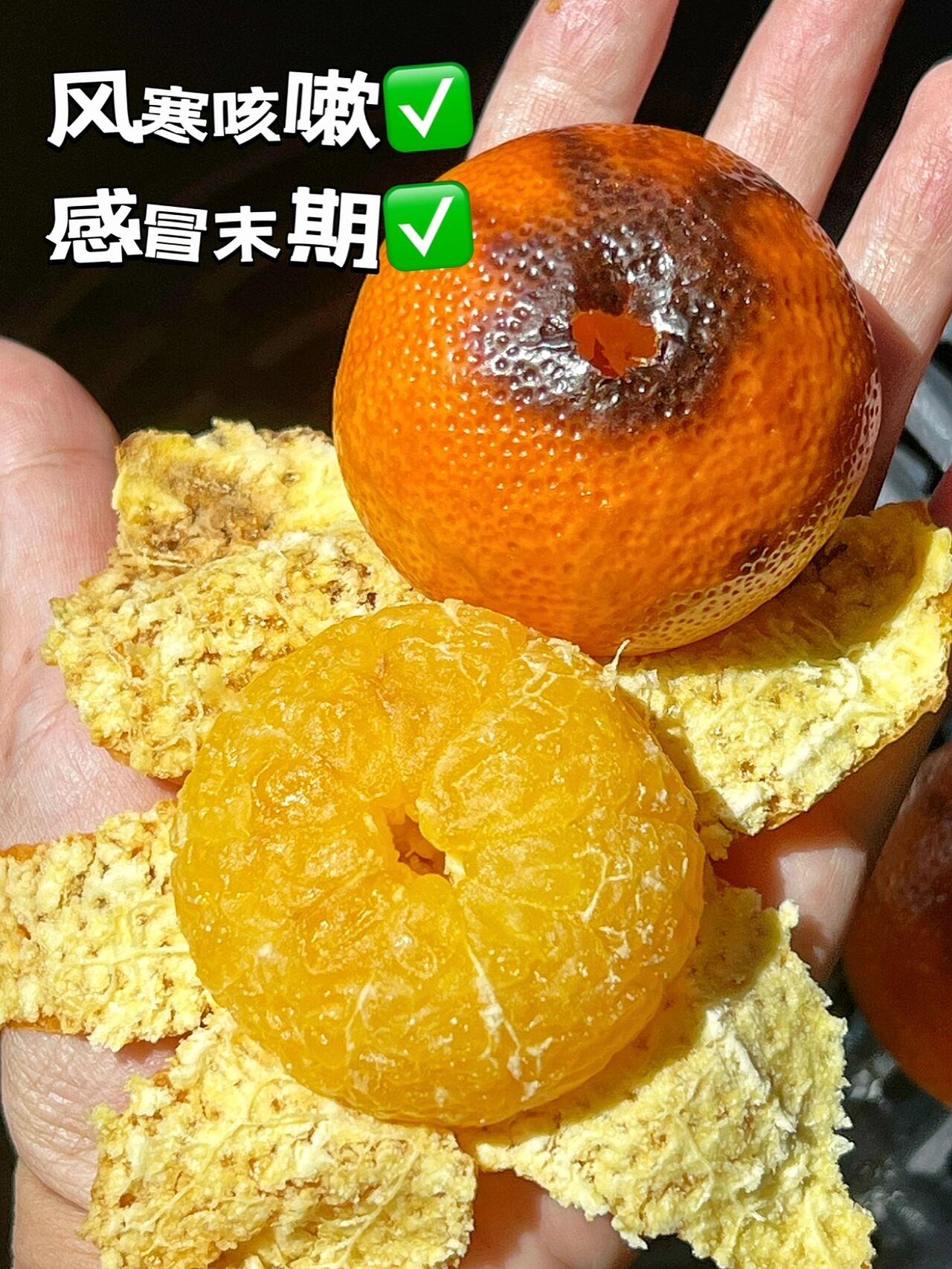 感冒咳嗽可以吃橘子吗