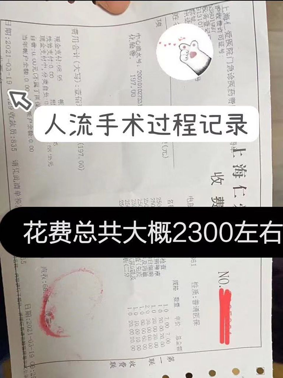 做人流一般在多少钱左右?
