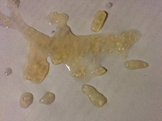 精子有颗粒状的东西是什么原因