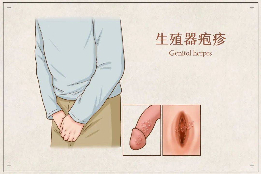 性病有哪些症状的表现?