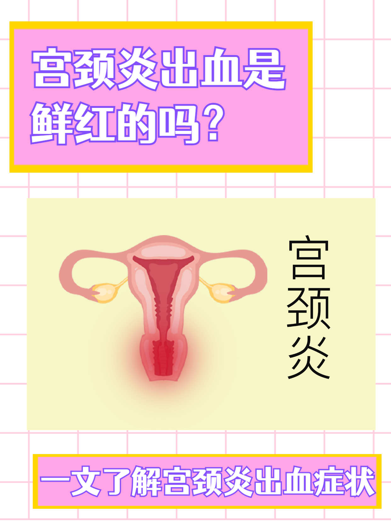 宫颈炎怎么引起的