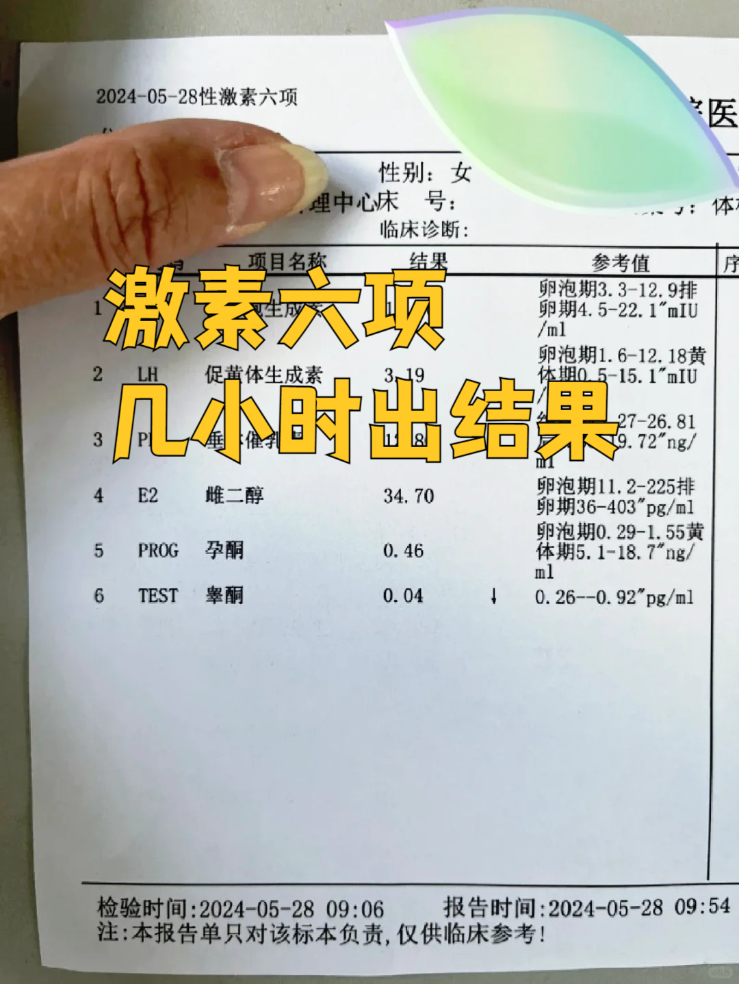 性激素六项检查时间是什么时候