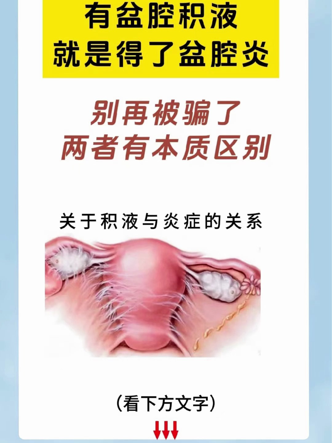 得了盆腔积液能过性生活吗