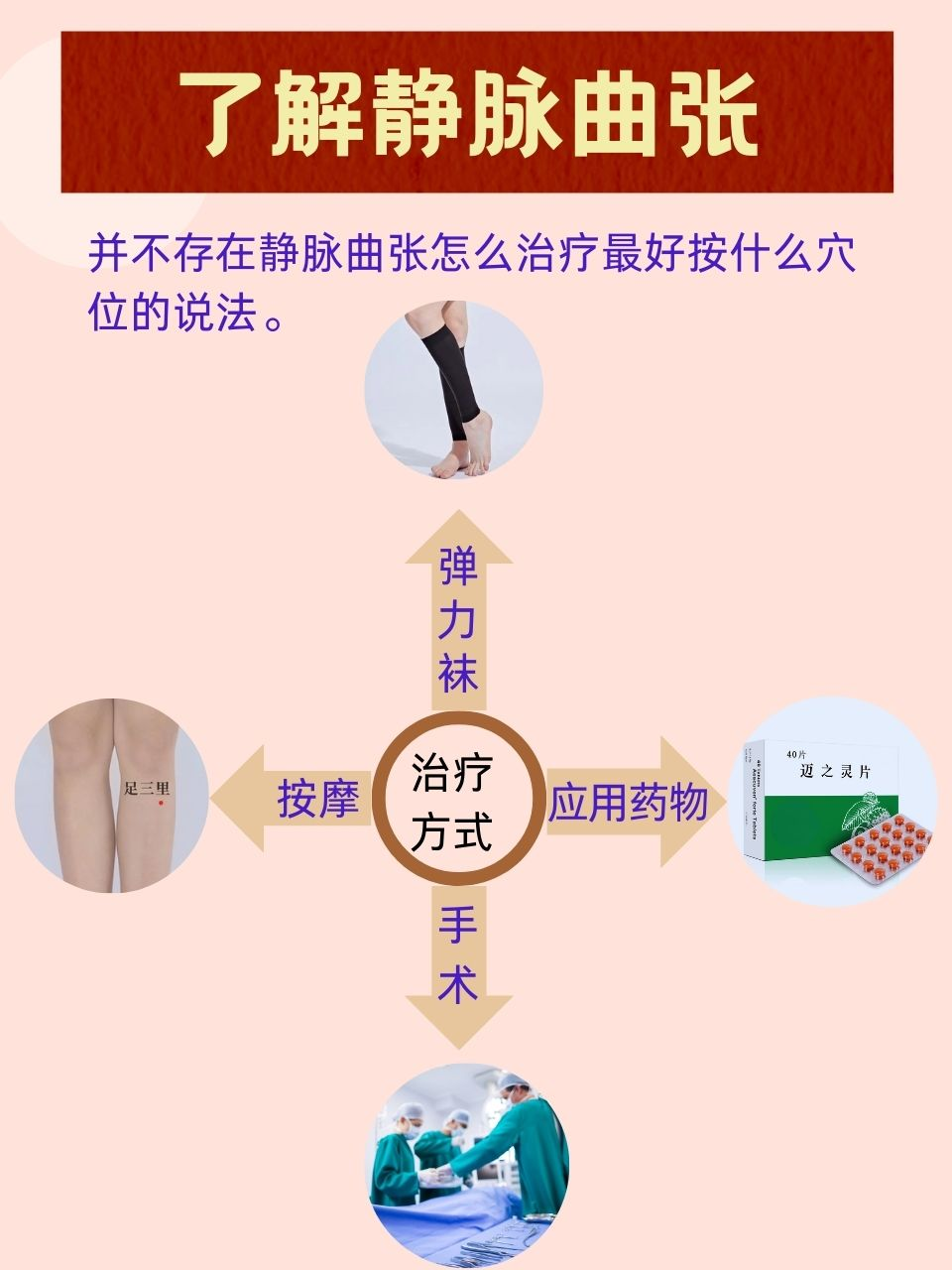 静脉曲张怎么能治好