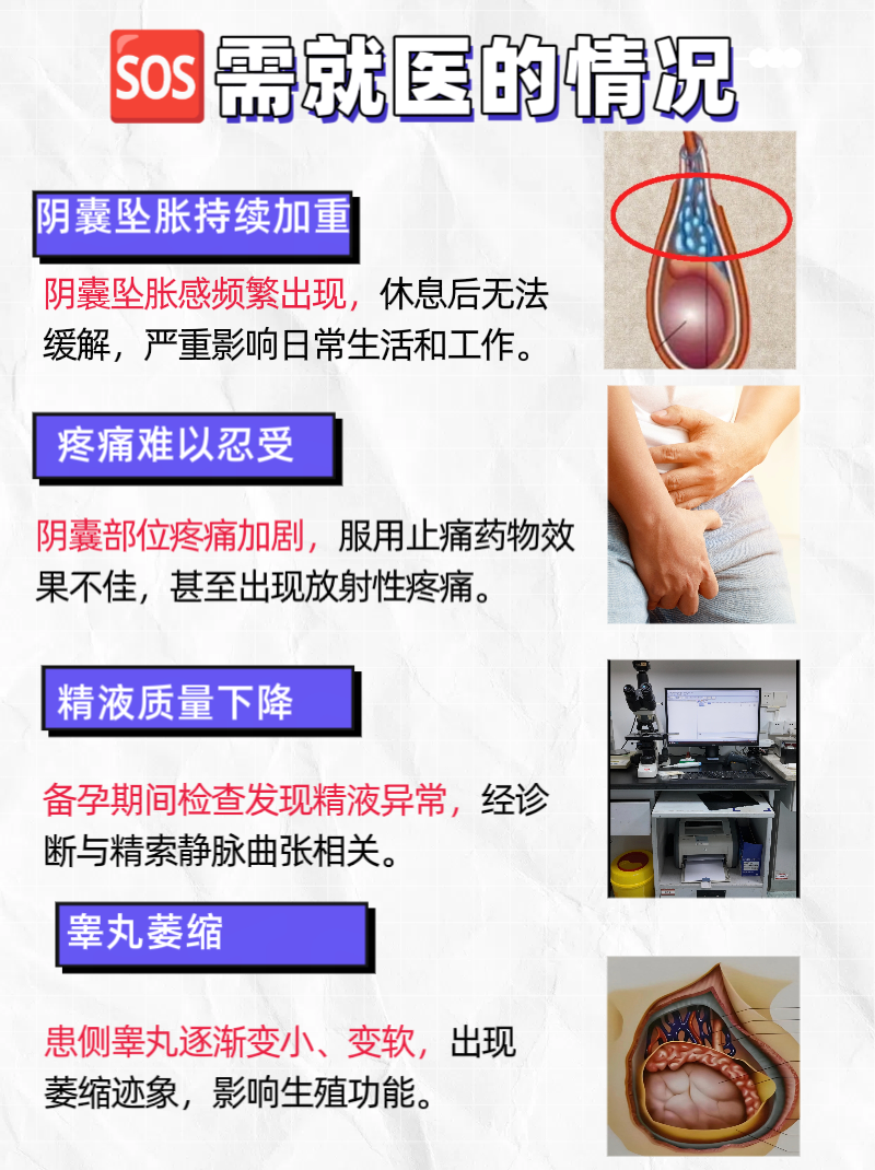 精索曲张是什么引起的