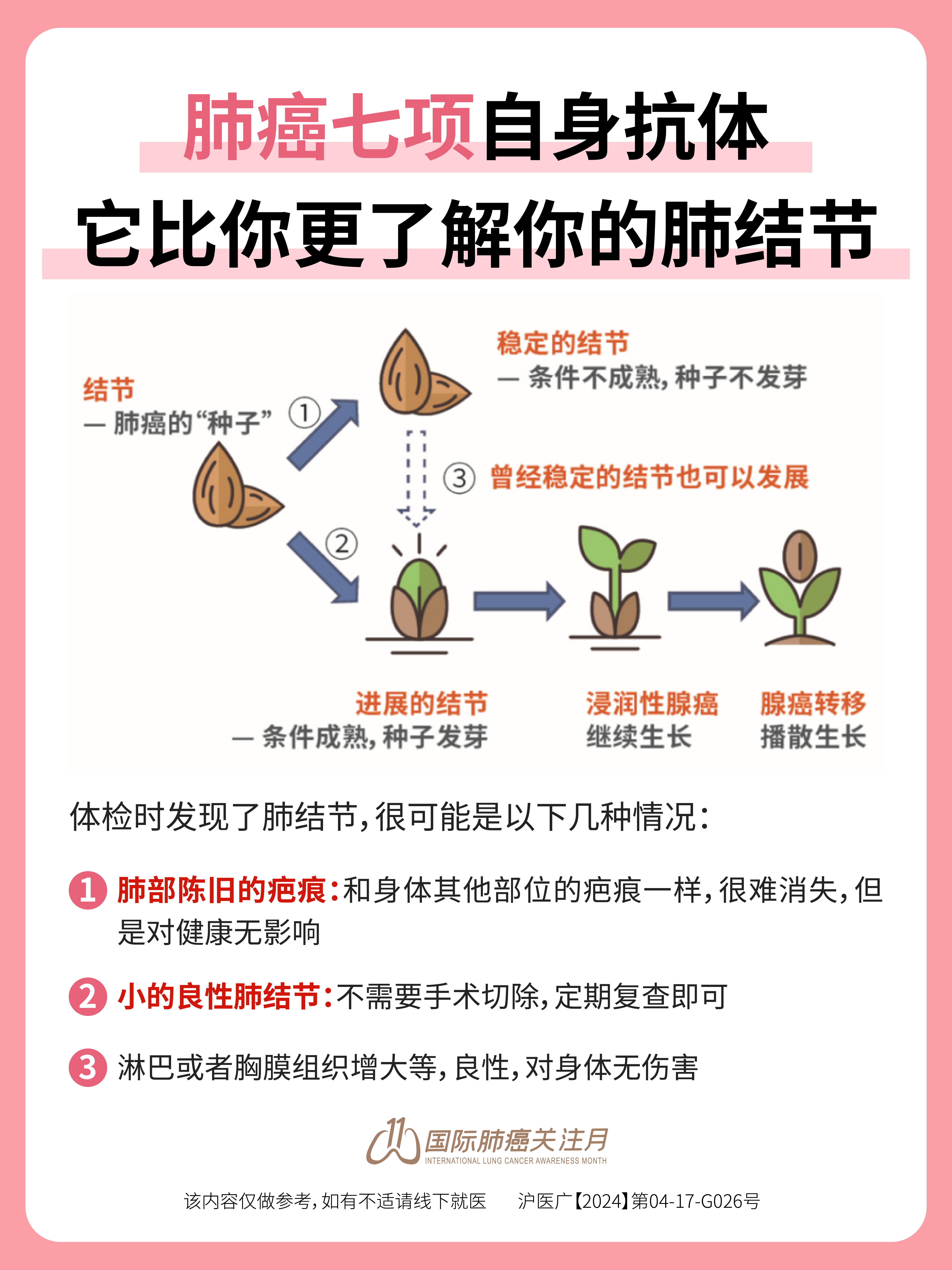 肺部结节是癌吗