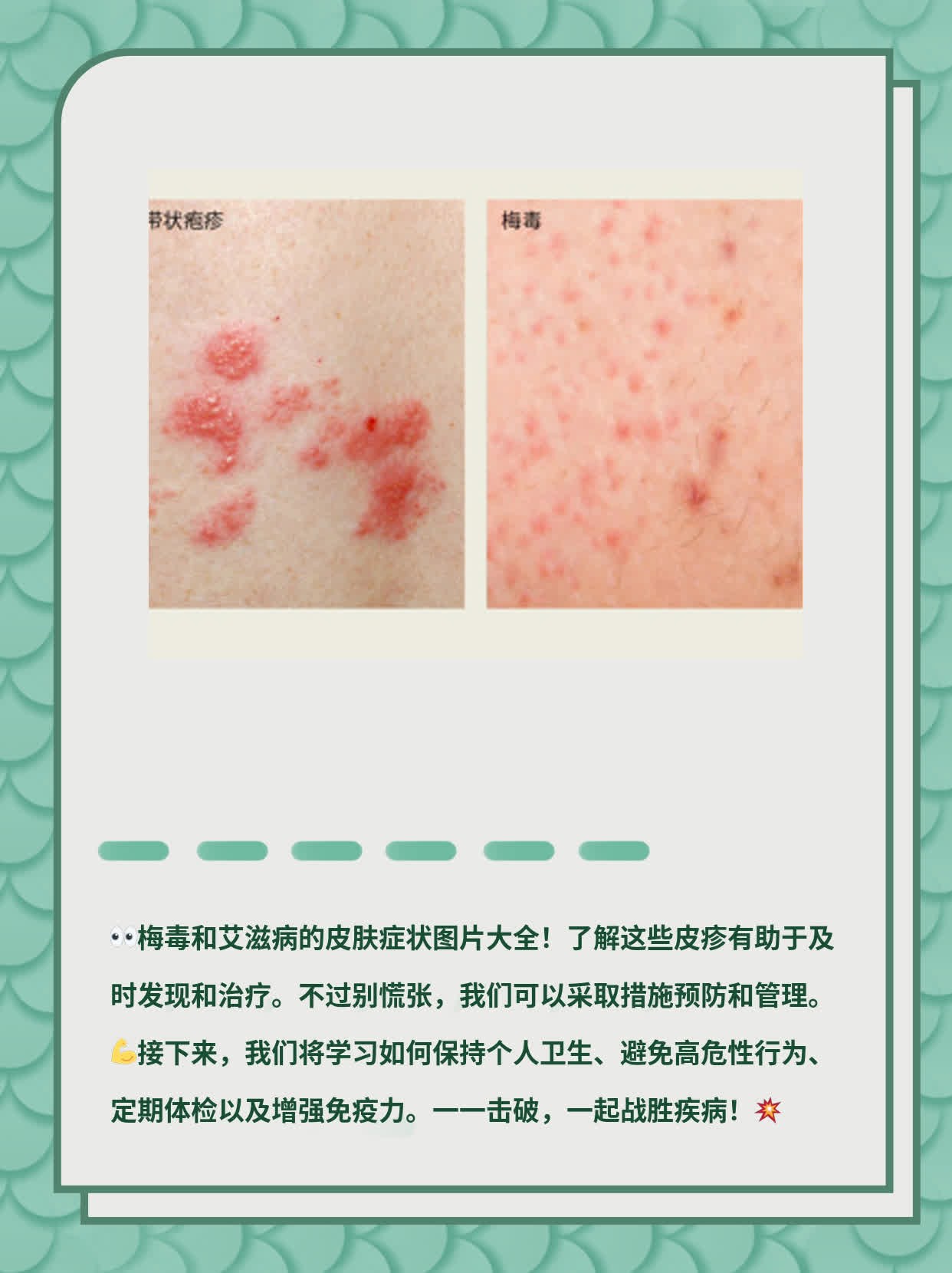 早期发现艾滋病能治好吗