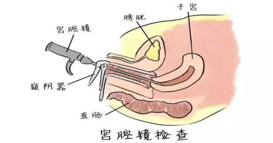 謇凝冬 第2页