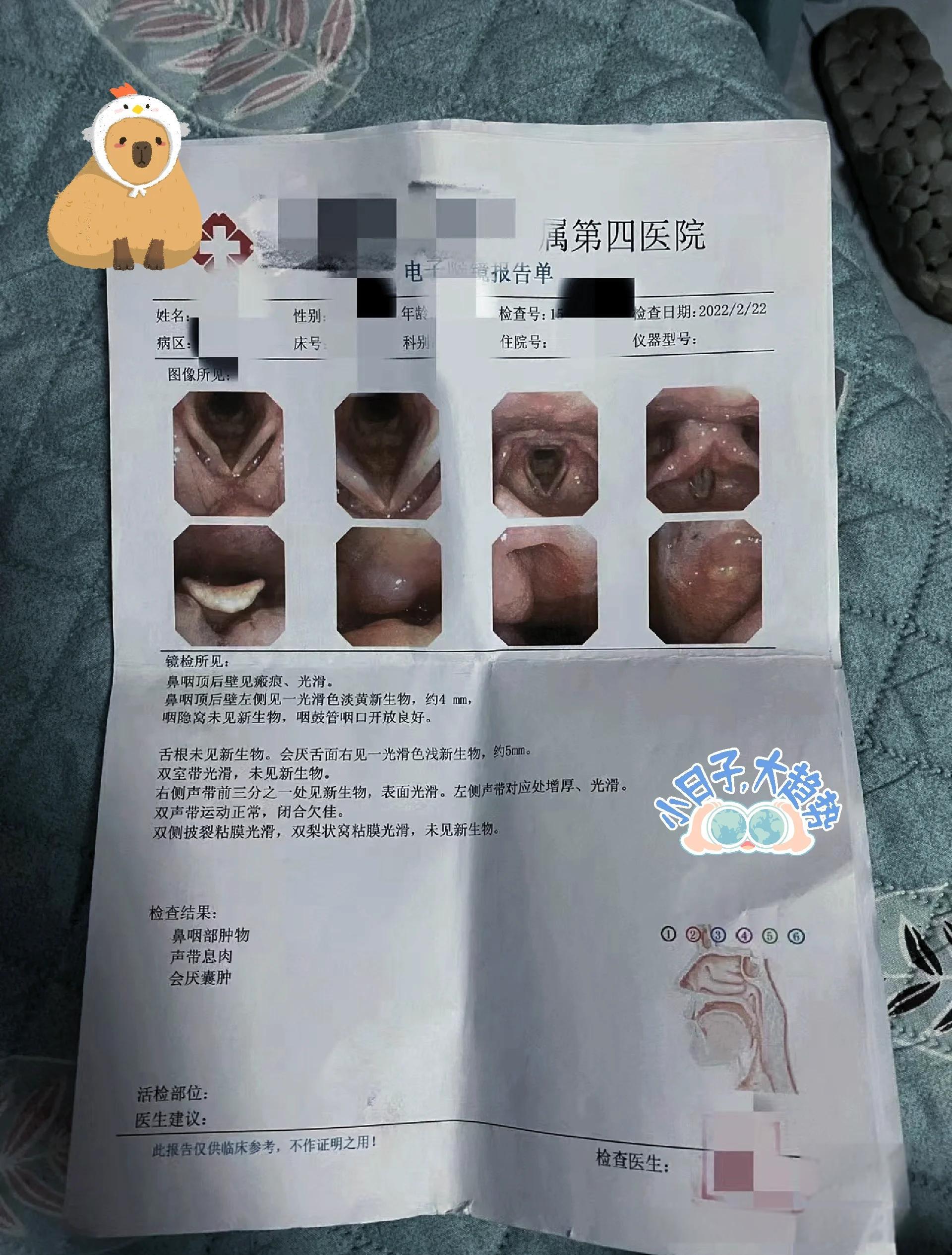 声带息肉什么原因会癌变吗?