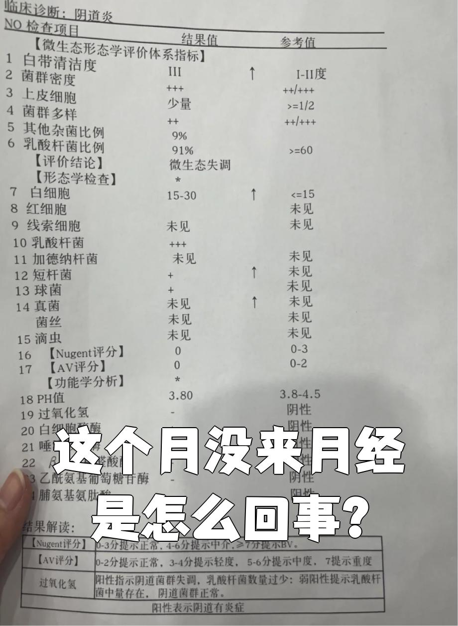 月经不正常是什么情况?