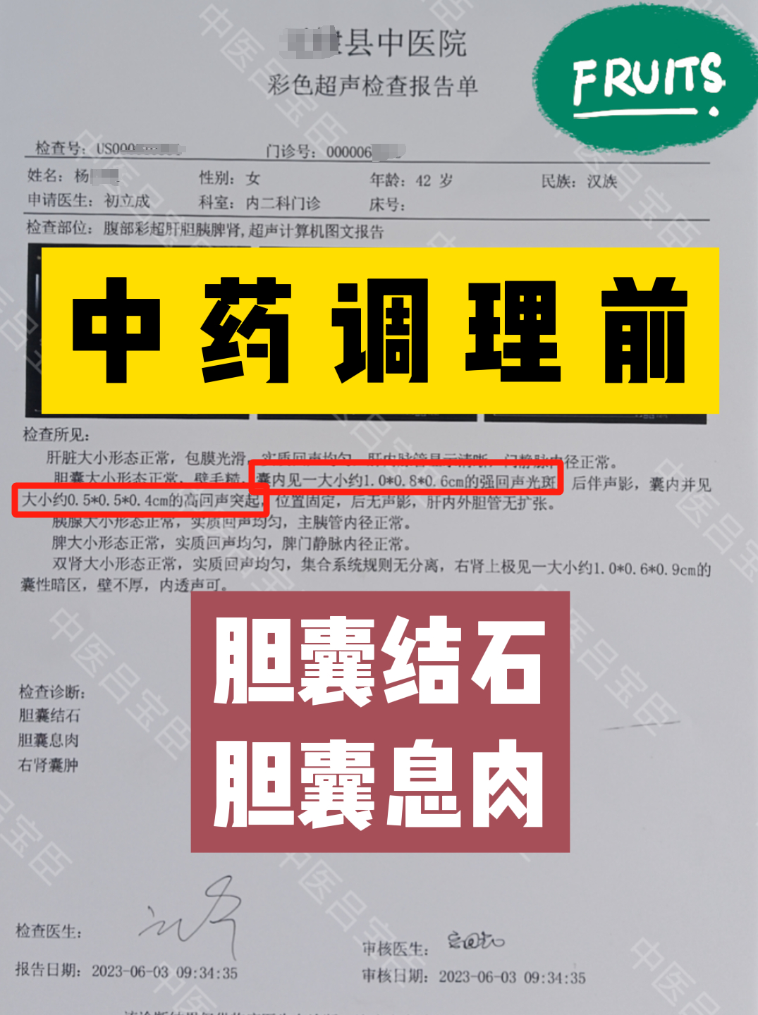 胆囊上有息肉怎么办才好