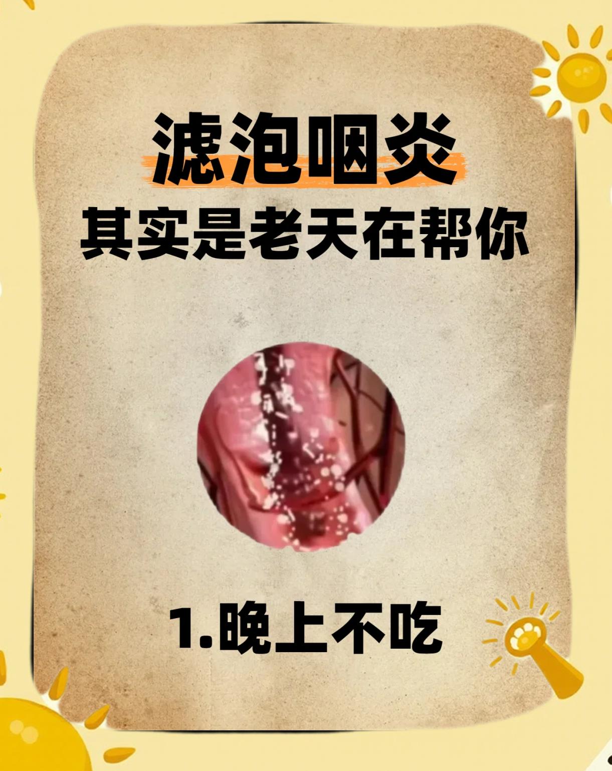 瓮斯 第2页
