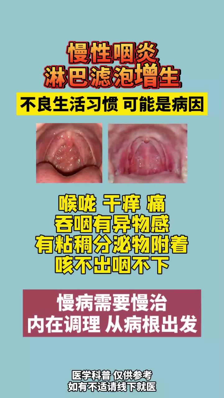 滤泡增生是什么原因导致的?