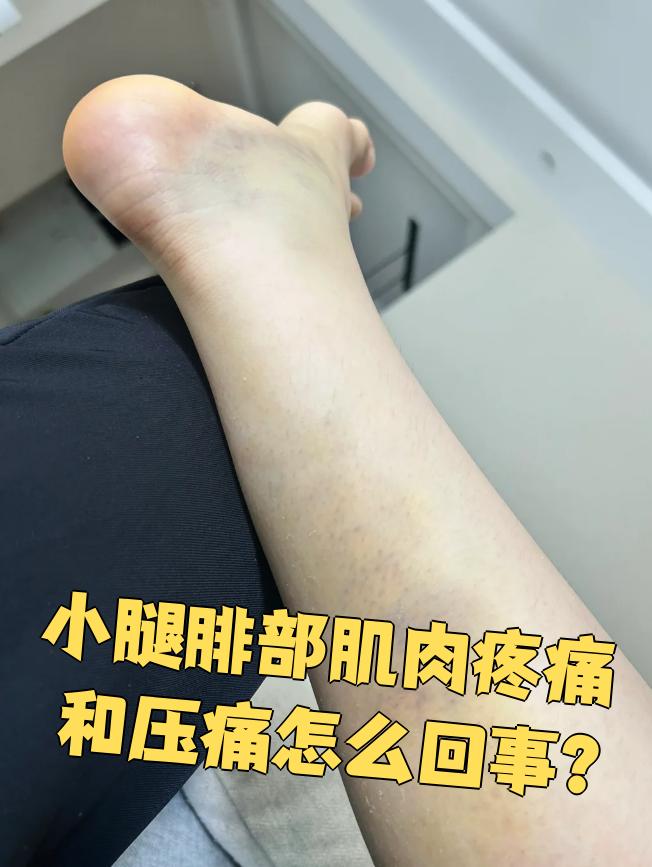 小腿肌肉疼痛是怎么回事?