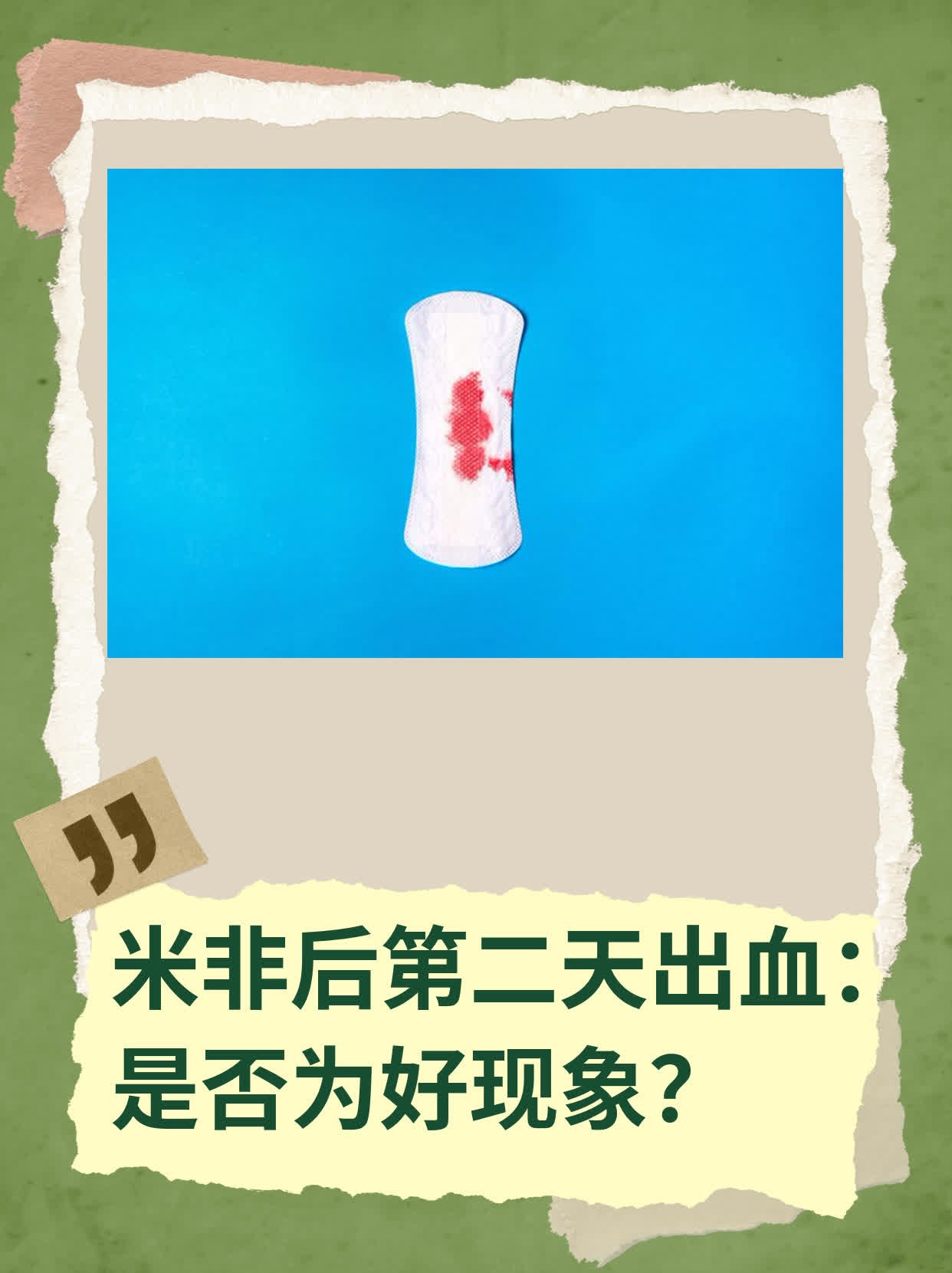 药流第一天会出血吗
