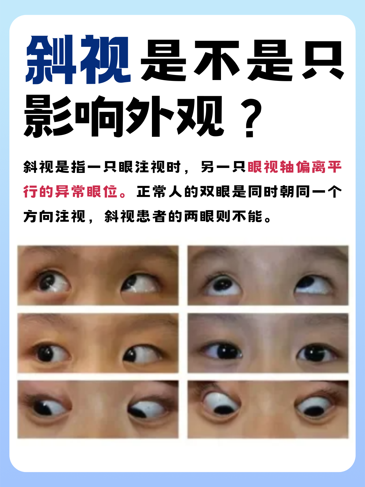 斜视手术有什么风险