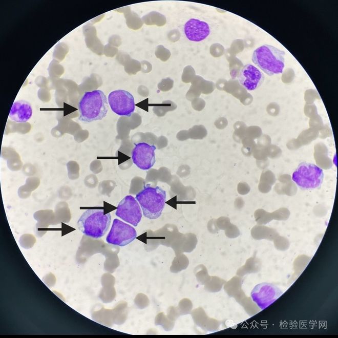什么是中性粒细胞?
